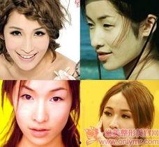 明星整容前太丑,曾因颜值太丑被热议