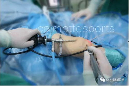 痛风看内料还是外科,内科学视角与外科学策略的融合探讨